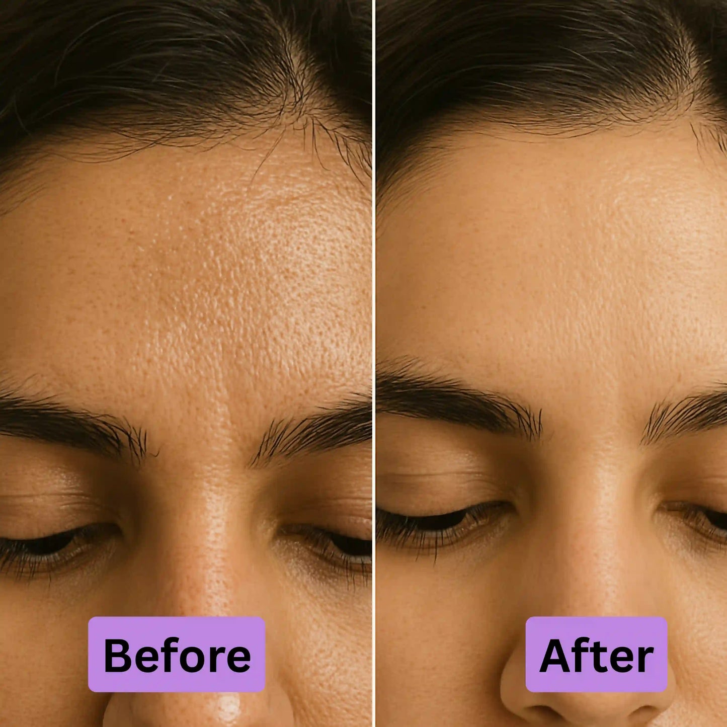 Before and after of rawah niacinamide