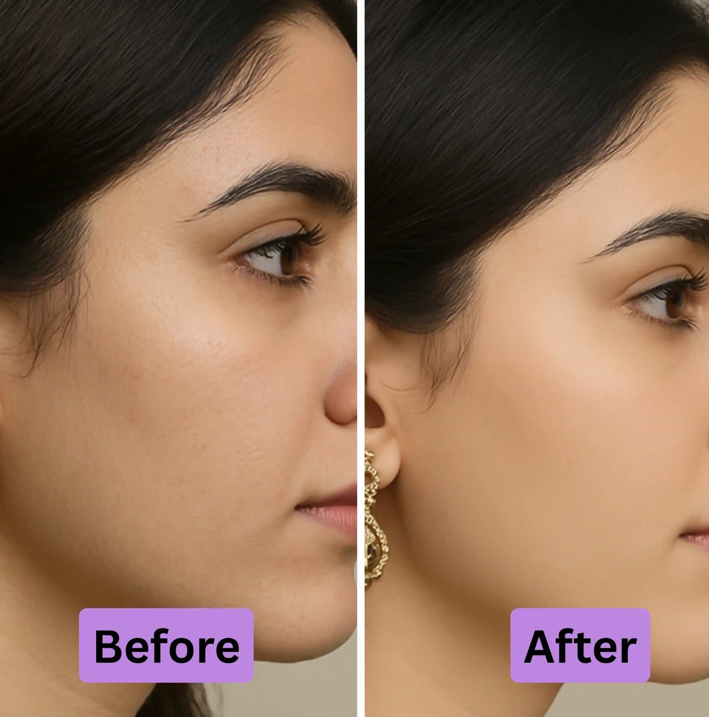 Before and after of rawah retinol